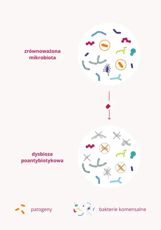 Dysbioza poantybiotykowa - probiotyk
